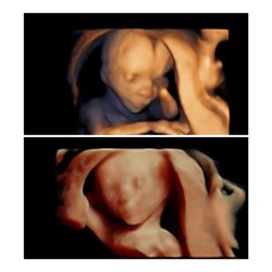 Baby Dimensions - Little one in #3D & #highdefinition at 15 weeks. You can achieve images like this is long as you are #wellhydrated.