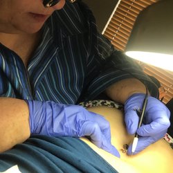 Palmetto Permanent Hair Removal