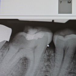 Joe Isaacson Dental - Oof a reminder of why we care for our teeth
