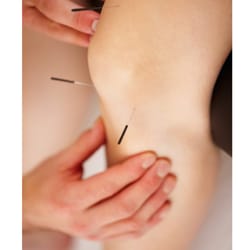 Ross McCallum, LAc - Acupuncture is great for knee pain, or almost any other pain.