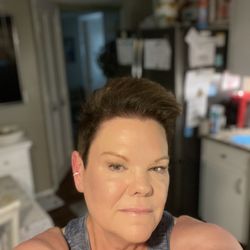 Age Revival Med Spa - And I'm 65!