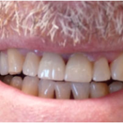 Advanced Dental Care