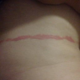 His burn from the rap His burn from the rap