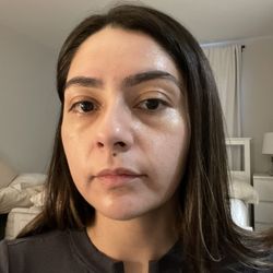 Beauty Lounge Medical Spa - Before
