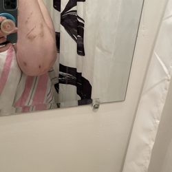 Welch Village Tubing - Scratches and bruise from rocks