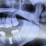 Photo of Advanced Dentistry by Soboh Liswi Tedini 