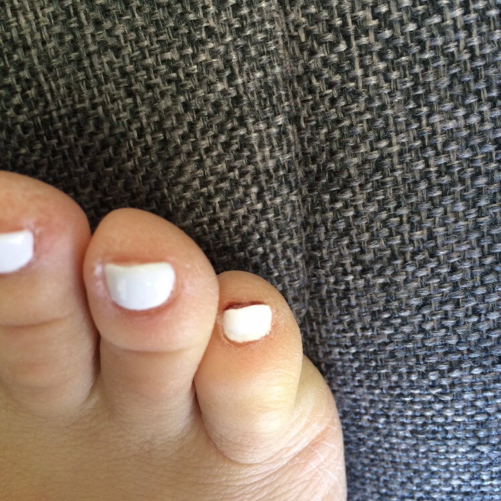 Be Polished Nails - Dried blood under my toenail. - Nail Salons Near Me - San Marcos, California