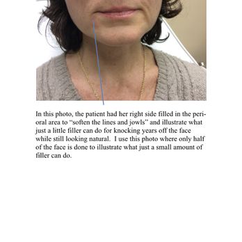 Radiant You Aesthetics - Medical Spas Near Me - Harrison, New York Radiant You Aesthetics - Medical Spas Near Me - Harrison, New York