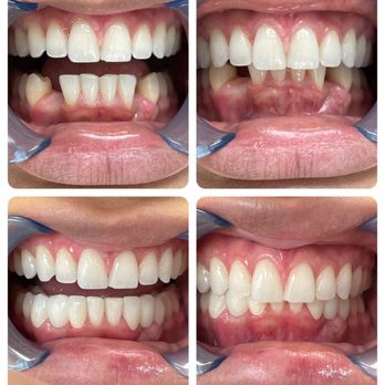 Nicholas Gih, DDS - General Dentistry Near Me - Claremont, California