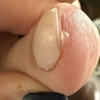 Nail Star & Organic Spa - Polish excess nail polish spilled over the edge and horrible job on the polish done by owner - Nail Salons Near Me - Torrance, California Nail Star & Organic Spa - Polish excess nail polish spilled over the edge and horrible job on the polish done by owner - Nail Salons Near Me - Torrance, California