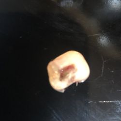 Nokomis Dental Care