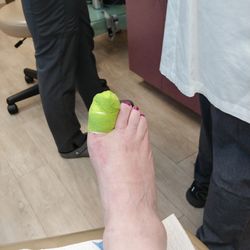 Had to have a procedure to fix it.