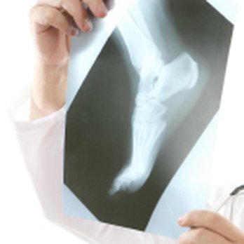 Lafayette Podiatry Associates - Podiatrists Near Me - Lafayette, Indiana Lafayette Podiatry Associates - Podiatrists Near Me - Lafayette, Indiana