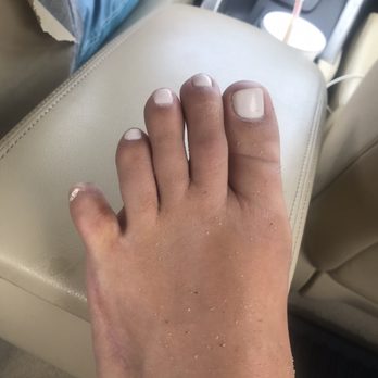 Outer Cape Health Services - Baby toe hanging off. - Family Practice Near Me - Harwich Port, Massachusetts