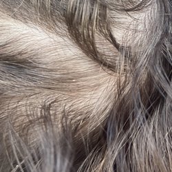 Lice Buster 805 - For a guaranteed treatment that cost $300 I shouldn't see nits the next day.