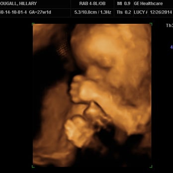 Hello Little One 3D - One of my favorite shots from my December '14 session - Diagnostic Imaging Near Me - Ocala, Florida Hello Little One 3D - One of my favorite shots from my December '14 session - Diagnostic Imaging Near Me - Ocala, Florida