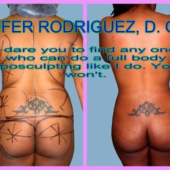 Ofer Rodriguez D.O - Cosmetic Surgeons Near Me - Miami, Florida Ofer Rodriguez D.O - Cosmetic Surgeons Near Me - Miami, Florida