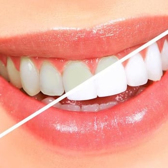 Jacob D. Young, DDS, PC - General Dentistry Near Me - Belton, Missouri Jacob D. Young, DDS, PC - General Dentistry Near Me - Belton, Missouri