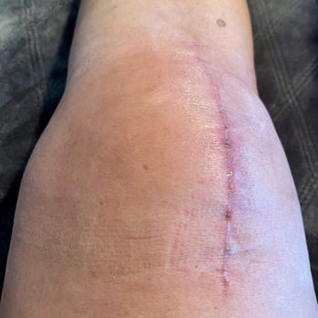 Russell M Nord, MD - Looking good! - Orthopedists Near Me - Fremont, California