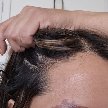 Third Eye Brows - Removal sessions for oversaturated microblading - Permanent Makeup Near Me Third Eye Brows - Removal sessions for oversaturated microblading - Permanent Makeup Near Me