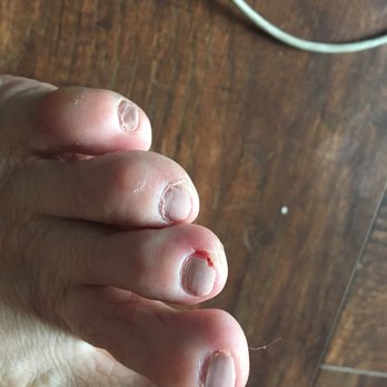 1st Rose Nails - bloody and ugly - Nail Salons Near Me - Los Angeles, California