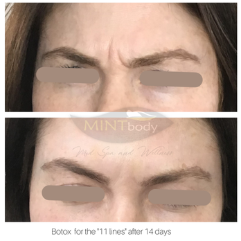 Mintbody Med Spa - Medical Spas Near Me - Cypress, Texas Mintbody Med Spa - Medical Spas Near Me - Cypress, Texas