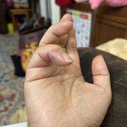 Liferiver Acupuncture - Before treatment