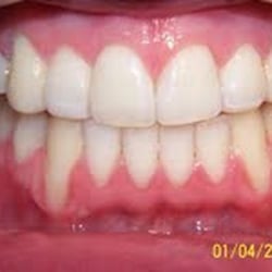 Cleveland Circle Dental Associates - Another beautiful result with a very happy patient.