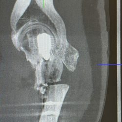 Pediatric Orthopaedic Specialists of Orange County