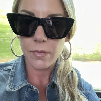 Prime MD Aesthetics + Wellness - Baseline (approx. 7 years of continuous Botox/Dysport, no skincare, tanning bed usage) - Medical Centers Near Me - Raleigh, North Carolina