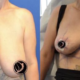 Surgery picture Surgery picture