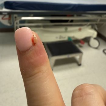 Inspire Nail Bar - Infection due to manicure. - Nail Salons Near Me - Cockeysville, Maryland Inspire Nail Bar - Infection due to manicure. - Nail Salons Near Me - Cockeysville, Maryland