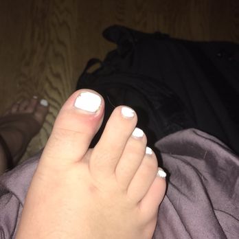 Sola Nails - My infected toe from dirty tool - Nail Salons Near Me - Burien, Washington Sola Nails - My infected toe from dirty tool - Nail Salons Near Me - Burien, Washington