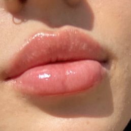 Lip filler