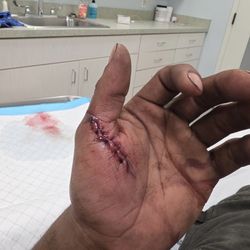 Greater Mobile Urgent Care - Black and Brown people face discrimination when seeking medical attention. Denied pain medication.
