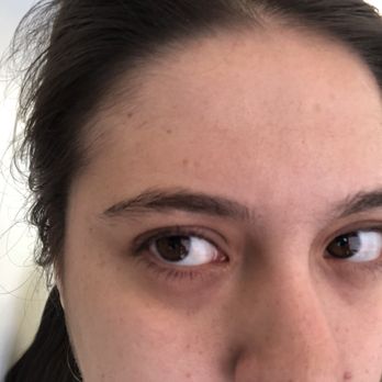 Queen Threading - Before photo angle 2 - Skin Care Near Me - Escondido, California