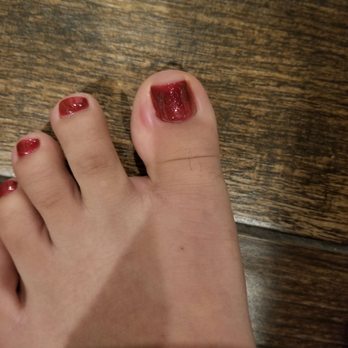 VNAILS - It should always be discussed with the customer first before removing what you think is an ingrown toenail! - Nail Salons Near Me - Orange, California VNAILS - It should always be discussed with the customer first before removing what you think is an ingrown toenail! - Nail Salons Near Me - Orange, California