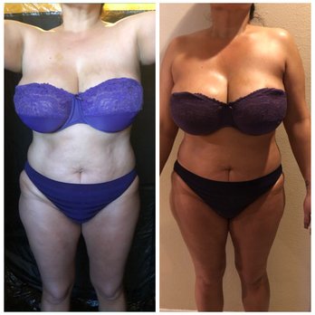 Spray Tans by Ally - Before and after - Spray Tanning Near Me