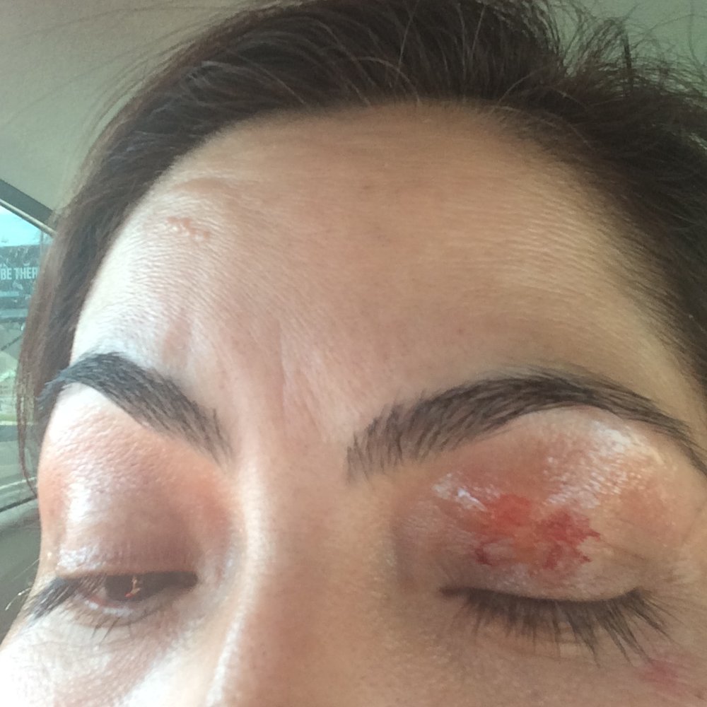 Nail Pros - Severely burned during an eyebrow waxing. Stay Away! - Nail Salons Near Me - San Jose, California Nail Pros - Severely burned during an eyebrow waxing. Stay Away! - Nail Salons Near Me - San Jose, California
