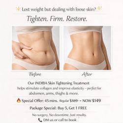 Balanced Body Spa - Lost the weight but dealing with loose skin? You're not alone. Our INDIBA Skin Tightening treatment helps stimulate collagen, improve elast