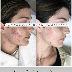 Dermatology Institute of Southern California - September '22 - June '23