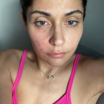 Ann Webb Skin Clinic - Skin Care Near Me - Houston, Texas Ann Webb Skin Clinic - Skin Care Near Me - Houston, Texas