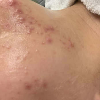 Cecylia Licensed Esthetician - Skin Care Near Me - Garfield, New Jersey Cecylia Licensed Esthetician - Skin Care Near Me - Garfield, New Jersey