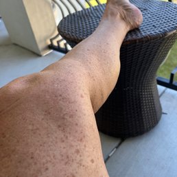 This is 3 days later and remember it was dark now all washed off This is 3 days later and remember it was dark now all washed off