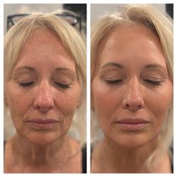 NovaGen Skin & Wellness