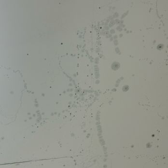 Milwaukee Athletic Club - More mold! - Gyms Near Me - Milwaukee, Wisconsin