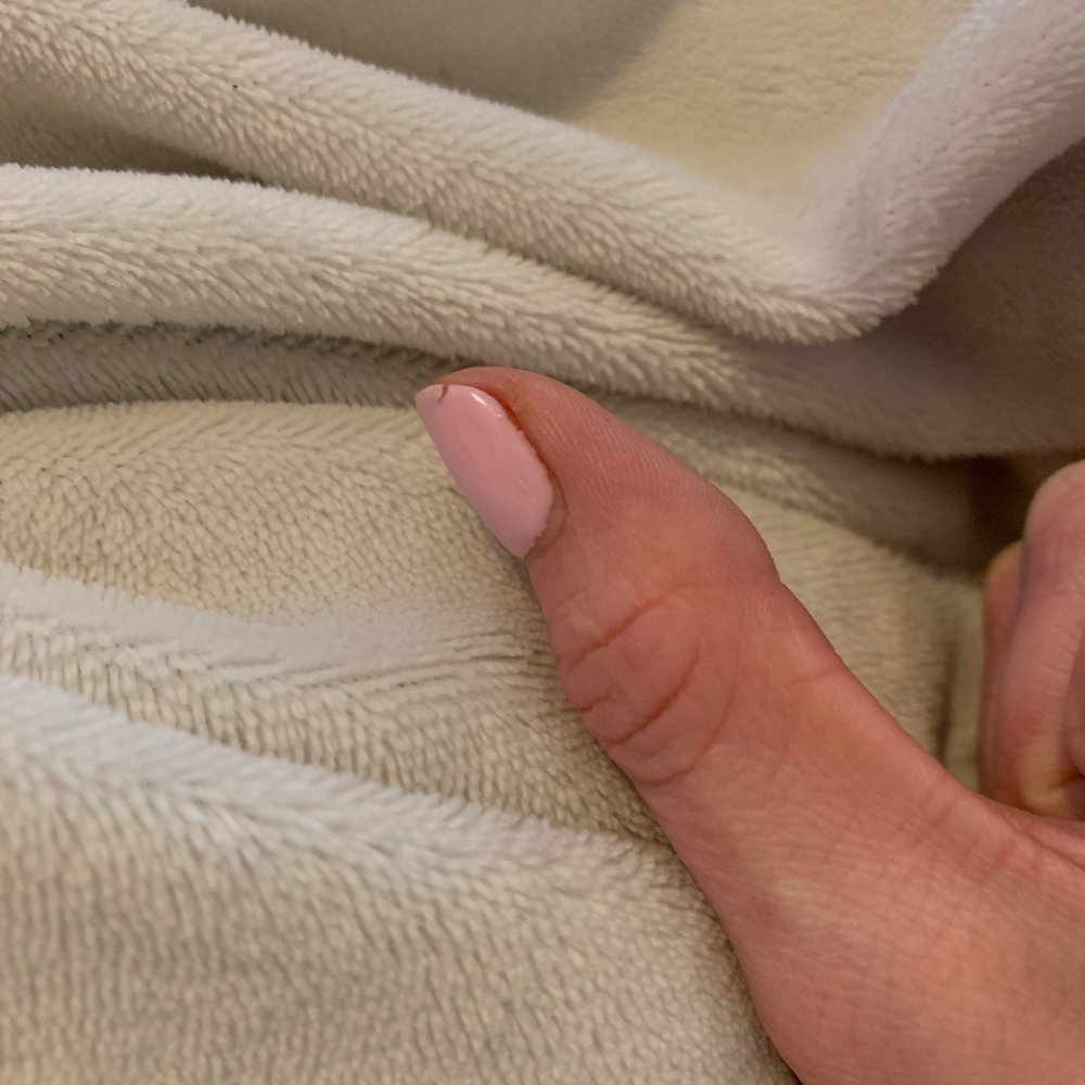 Bellacures - Chipped nail after a gel manicure on 4-14-22 - Nail Salons Near Me - Dallas, Texas Bellacures - Chipped nail after a gel manicure on 4-14-22 - Nail Salons Near Me - Dallas, Texas