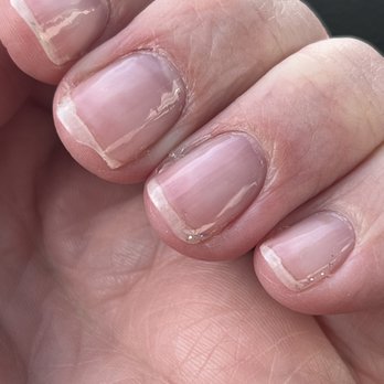 No 1 Nail - Chipped nail and glitter left on nail from previous good manicure. - Nail Salons Near Me - Dubuque, Iowa