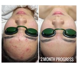 Skin Rejuve By Tiffany