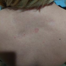 Nevada Pain Care - More ATROPHY